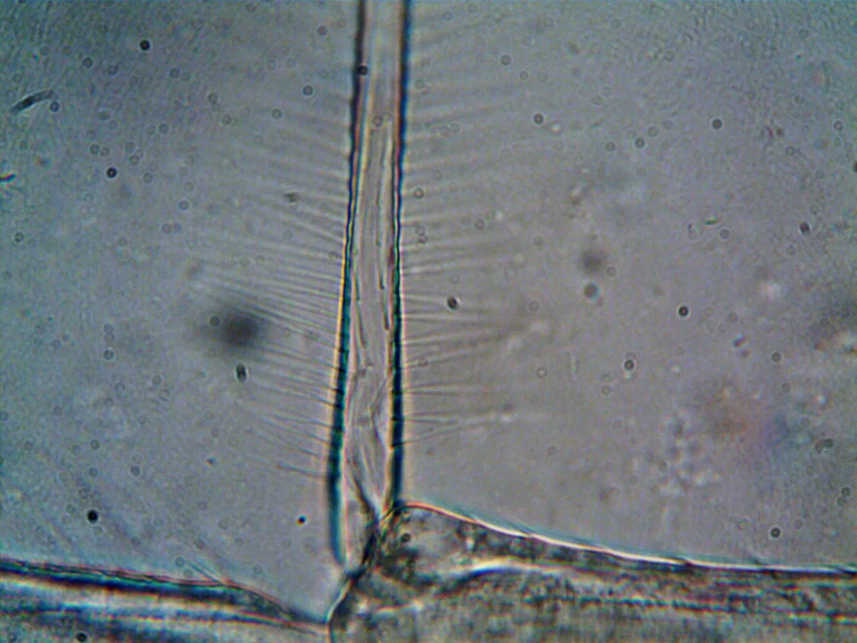 Détection microscopique de protéines endommagées et mal conformées dans une cellule